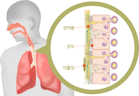 설하면역치료의 효과